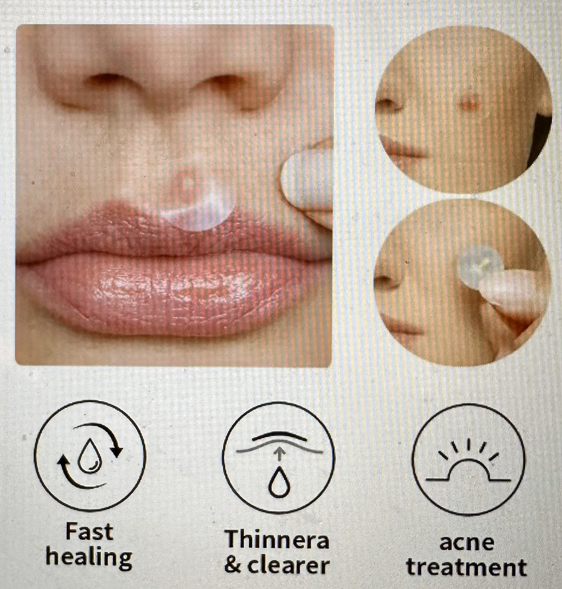 Acne Blemish Skincare Patches