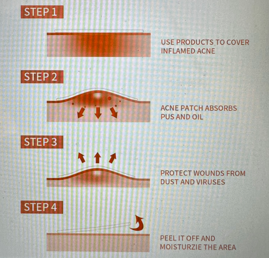 Acne Blemish Skincare Patches